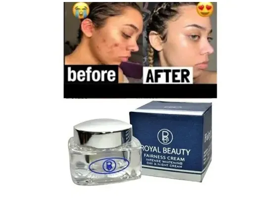 Royal Beauty Day & Night Fairness Cream (rbfc)